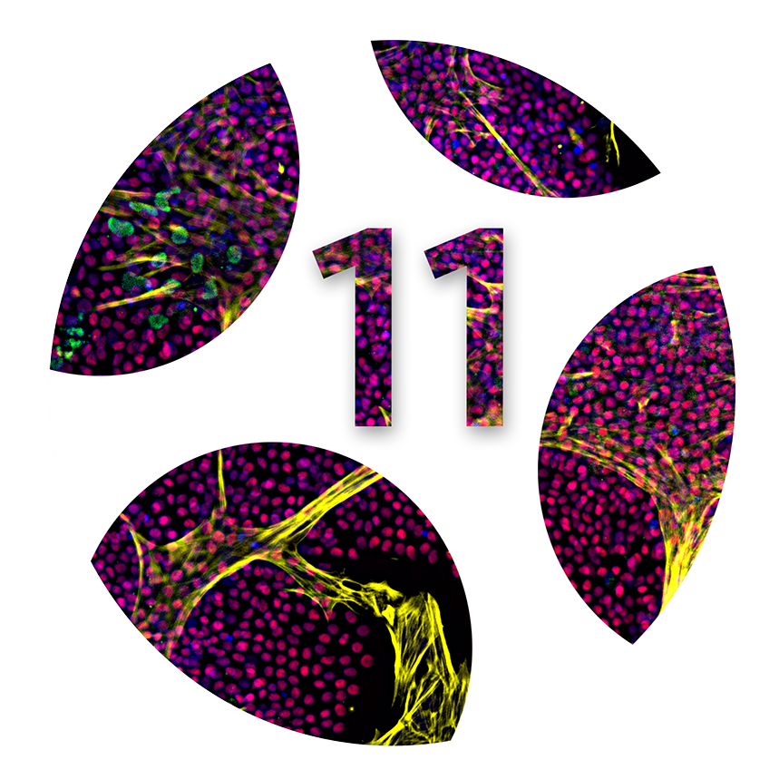 Logo 11th International Meeting StN NRW